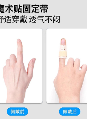 BSKT手指弯曲骨折夹板固定护指套关节伸直锤状指