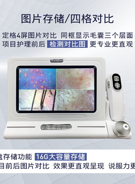 高清头皮检测仪理发店皮肤测试仪毛囊高清毛发检测仪器存储一体机