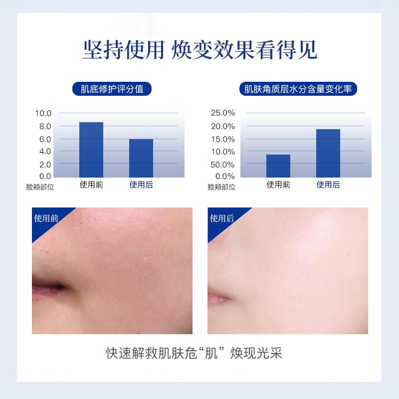 NTD氨基酸麒麟竭熬夜面膜舒缓补水保湿便携清洁涂抹免洗21 - 图1