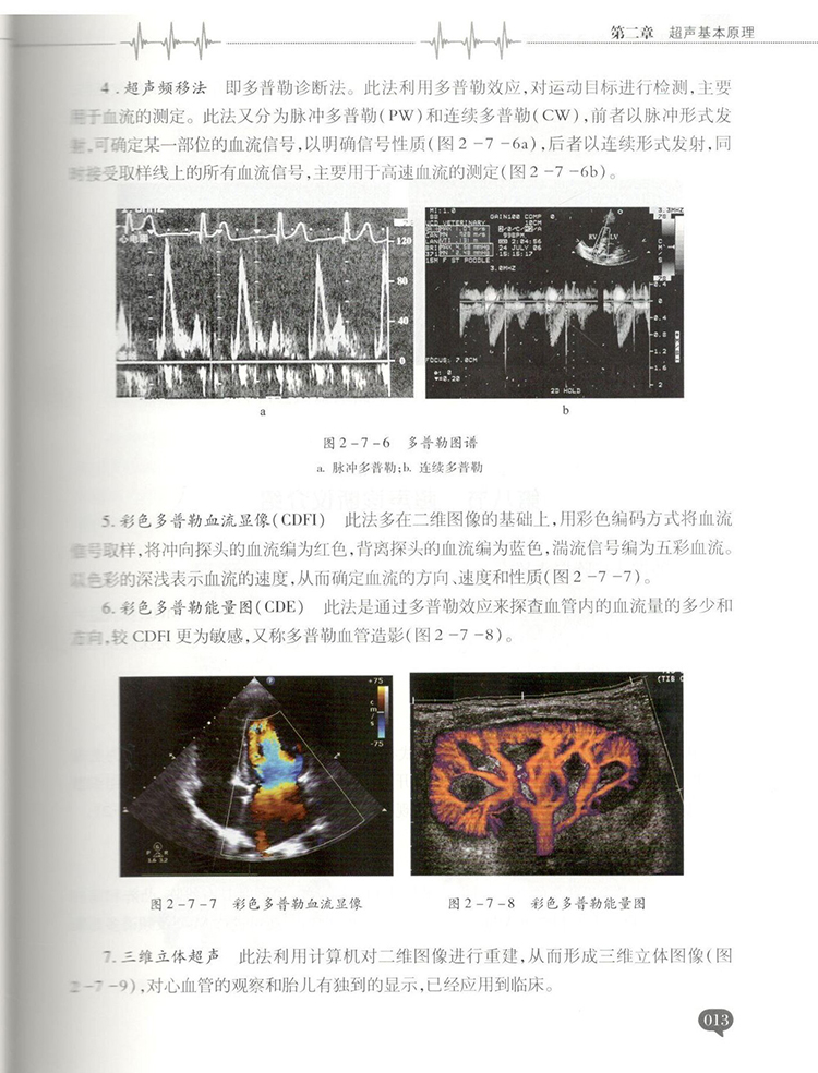 手把手教你学B超诊断b超书诊断书彩色多普勒设备检查技术报告书系医学影像学诊断学心脏腹部乳腺四肢彩超技术图像超声入门b超入门 - 图2