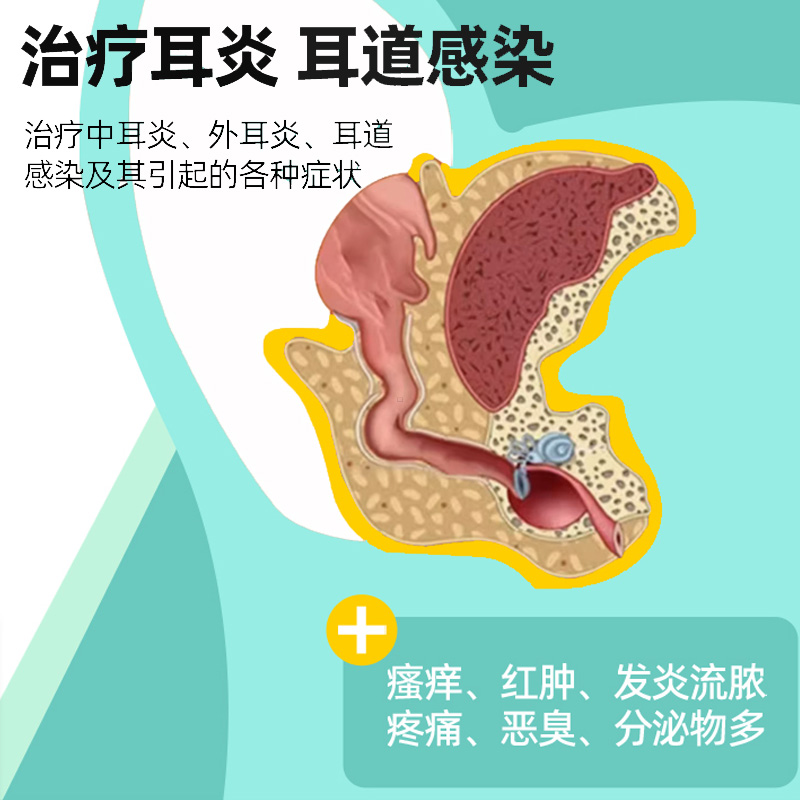 耳准舒猫咪耳螨药复方制霉菌素软膏宠物狗滴耳油洗耳液耳炎耳肤灵 - 图1