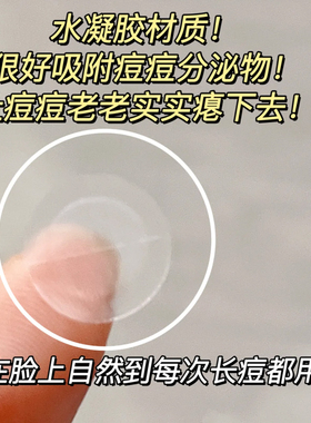韩国OliveYoung隐形痘痘贴炒薄净痘急救青春痘遮瑕痘印102贴