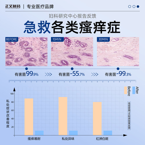 苦参洗液女性黄柏护理阴道抑菌液妇科私处外阴止痒去异味冲洗剂炎 - 图1