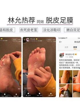 【蜕去老茧嫩双脚】去死皮足膜套
