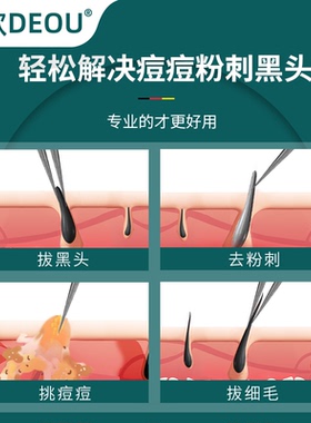 德国细胞去黑头闭口镊子痘痘针