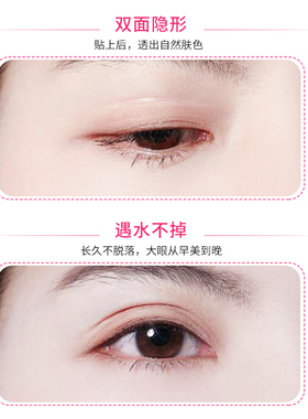 双面橄榄型双眼皮贴女肿泡眼透气