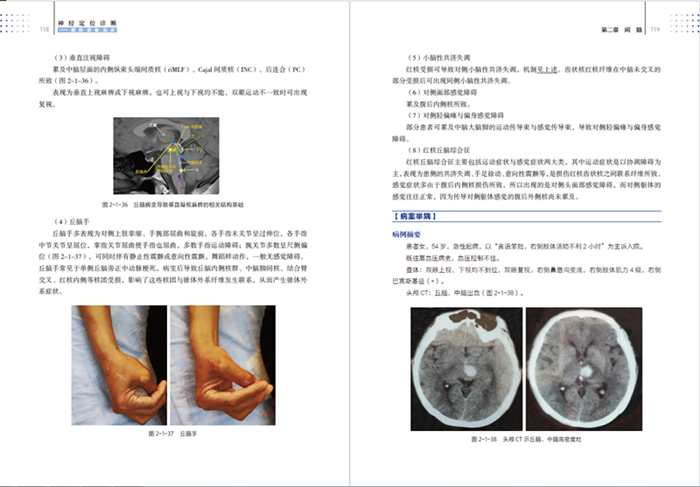 神经定位诊断 解剖·影像·临床 神经解剖 神经定位诊断知识实用参考书 脑脊液循环 延髓解剖与影像 李贺吴圣贤唐伟神经影像书 - 图2