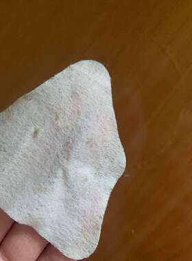 猴面包按摩油融解黑头疏通毛孔