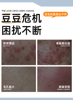 澳洲SKINB5祛痘套装洁面精华面膜三部曲黑头闭口油痘肌粉刺毛孔大