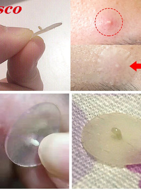 Acne Pimple Patch Stickers Acne Treatment Pimple Remover祛痘