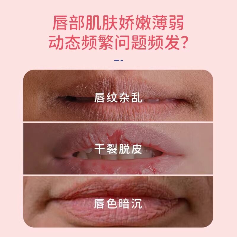 图 5
