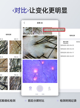 Mriya便携毛囊检测仪图片记录1件