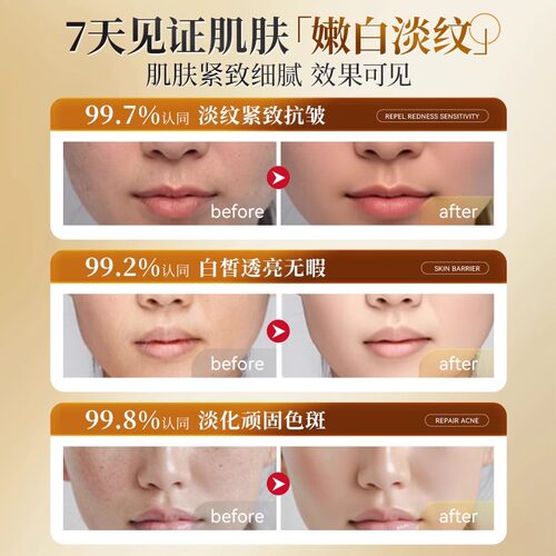 左旋vc维C精华液美斑白提亮去黄改善暗沉肤色烟酰胺外用 - 图3