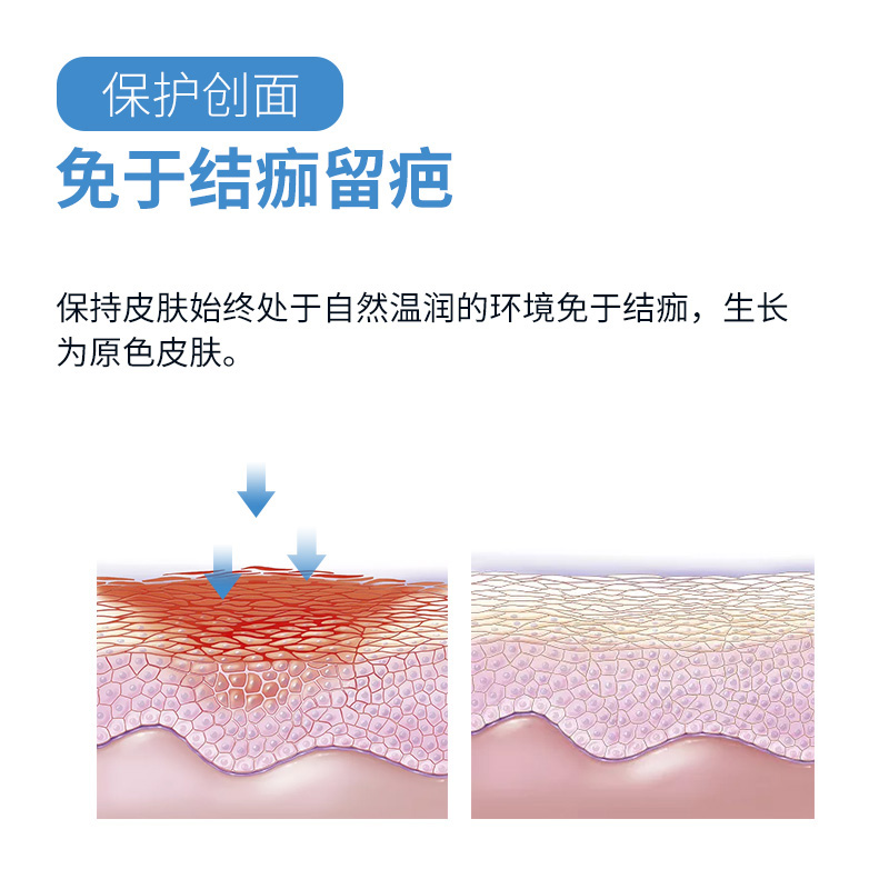 雷恩贝烫伤膏烧烫伤外用皮肤开水火烫灼伤水泡疤痕儿童成人修复膏-图1