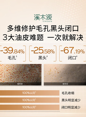 溪木源层孔菌油敏肌水乳套装