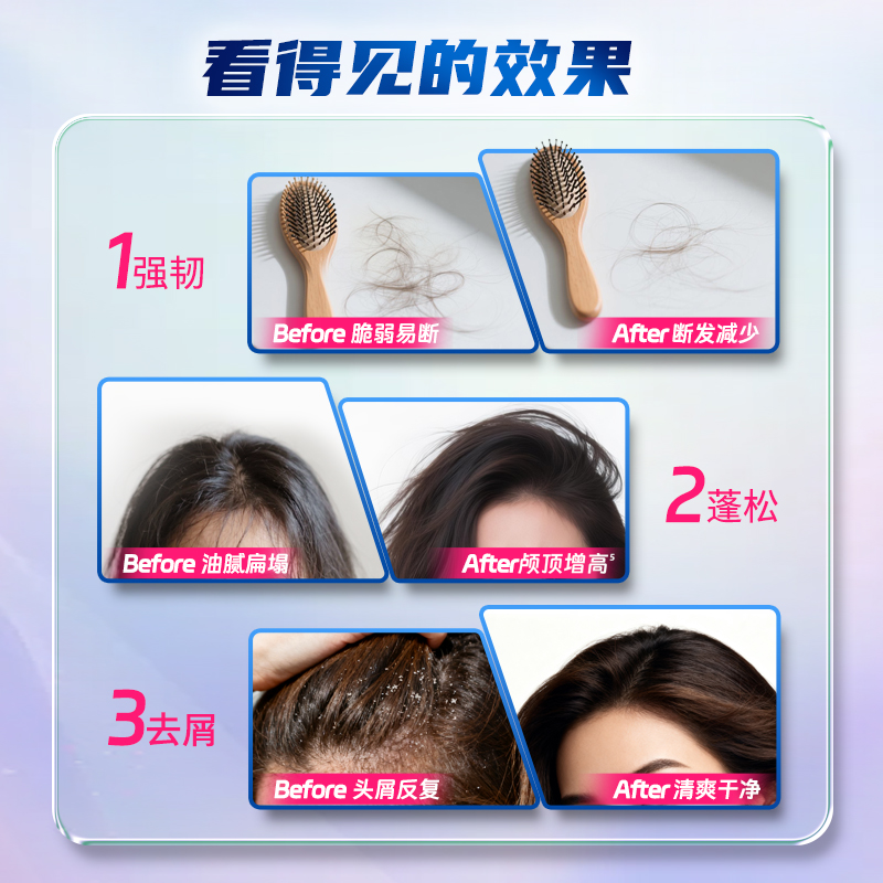 曼秀雷敦selsun潇洒洗发水丰盈去屑修护头皮控油防断发二硫化硒 - 图2