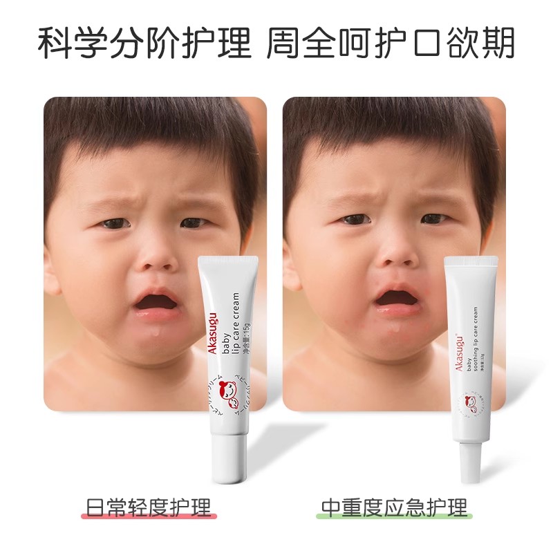 akasugu爱舒屋婴儿唇周膏宝宝口水疹膏新生儿专用特护膏保湿
