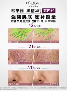 欧莱雅黑精华抗皱精华液15ml*4