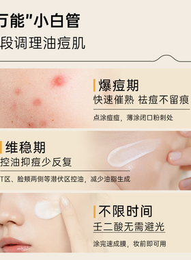质润壬二酸祛痘淡印面部护理产品