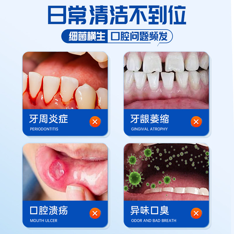 医用漱口水杀菌炎消牙周炎牙龈萎缩肿痛除口臭牙结石持久留香专用,淘宝优惠券,粉丝福利购,淘宝优惠卷