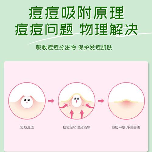 芙雷琳茶树痘痘贴隐形祛痘隔离净痘贴可上妆隔离舒缓轻薄净痘贴 - 图3