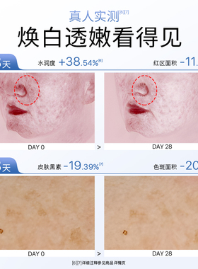 希芸美白祛斑淡斑水乳套装肌肤