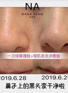 樱肌皂清洁收缩清透毛孔