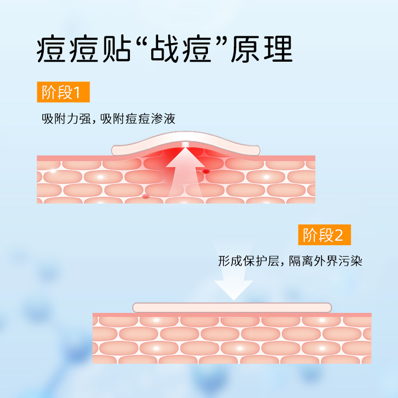 馥佩祛痘舒缓精华液痘痘贴轻薄透气淡化痘印净痘男女青春痘护肤,淘宝优惠券,粉丝福利购,淘宝优惠卷