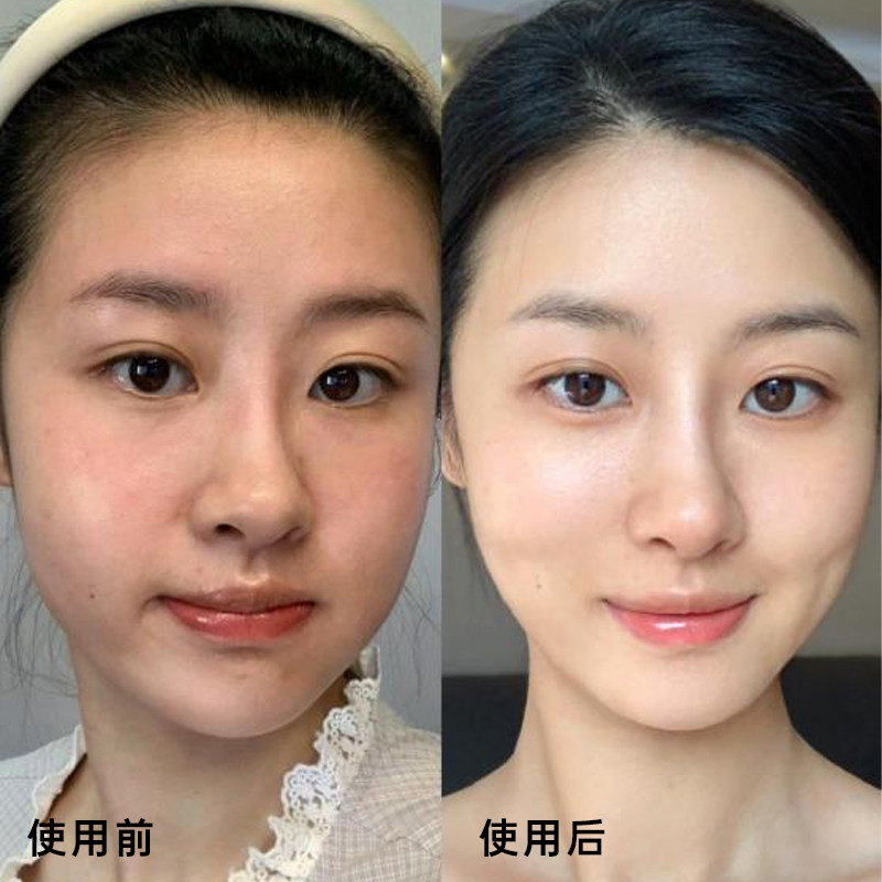 敷尔佳人参水油次抛精华抗皱紧致补水保湿养肤以油女温和卫生方便,淘宝优惠券,粉丝福利购,淘宝优惠卷