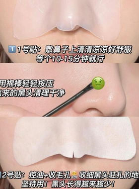 小气泡去黑头！ilso一苏清颜鼻贴