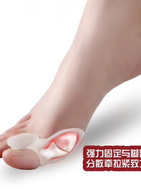 可穿鞋拇指外翻矫正器成人儿童