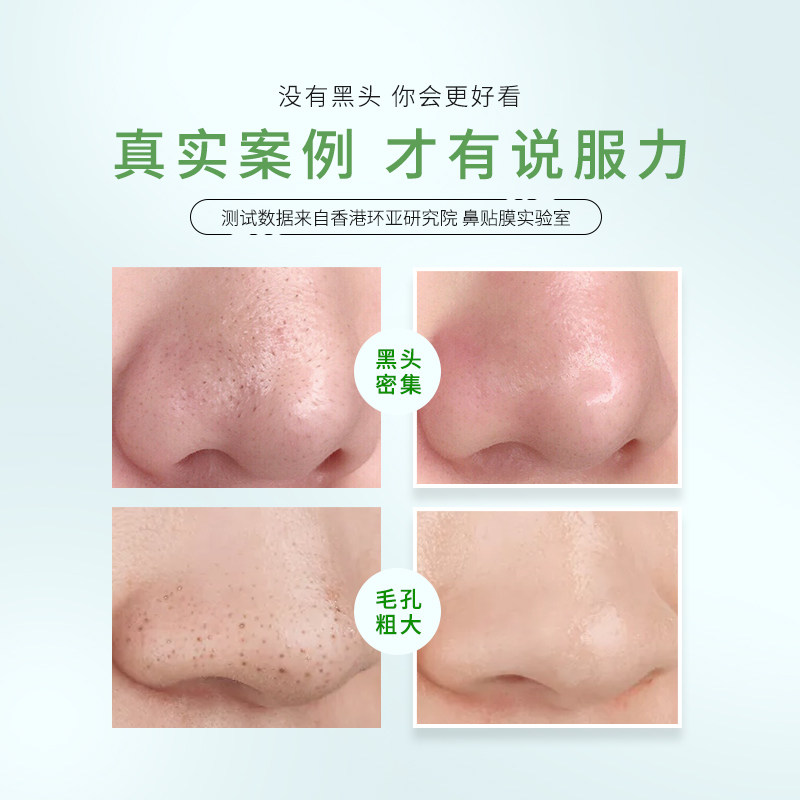 法兰琳卡收敛紧致套装男女鼻贴膜 法兰琳卡鼻帖