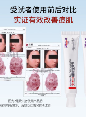安美拉凝胶去闭口痘坑修复护肤品