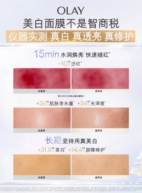 【双11现货】OLAY玉兰油水光小白瓶面膜补水舒缓美白提亮烟酰胺
