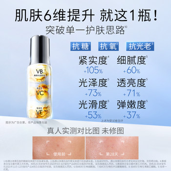 OLAY Olay anti-sugar ຕຸກນ້ອຍສີຂາວ niacinamide facial essence ປັບປຸງຄວາມຫມອງຄ້ໍາ, ຂາວແລະສົດໃສ, antioxidants ແລະຕ້ານການ້ໍາຕານ.