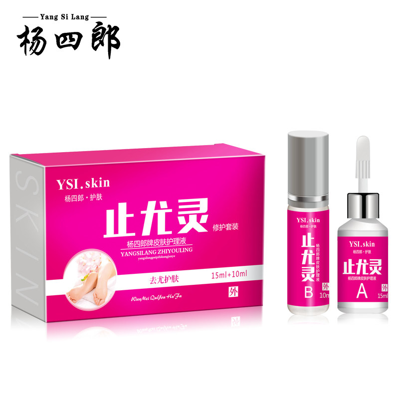 鸡眼膏鸡眼贴脚趾疣净肉刺老茧手部 杨四郎足部健康