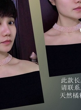 甲状腺术后遮挡天然淡水珍珠女