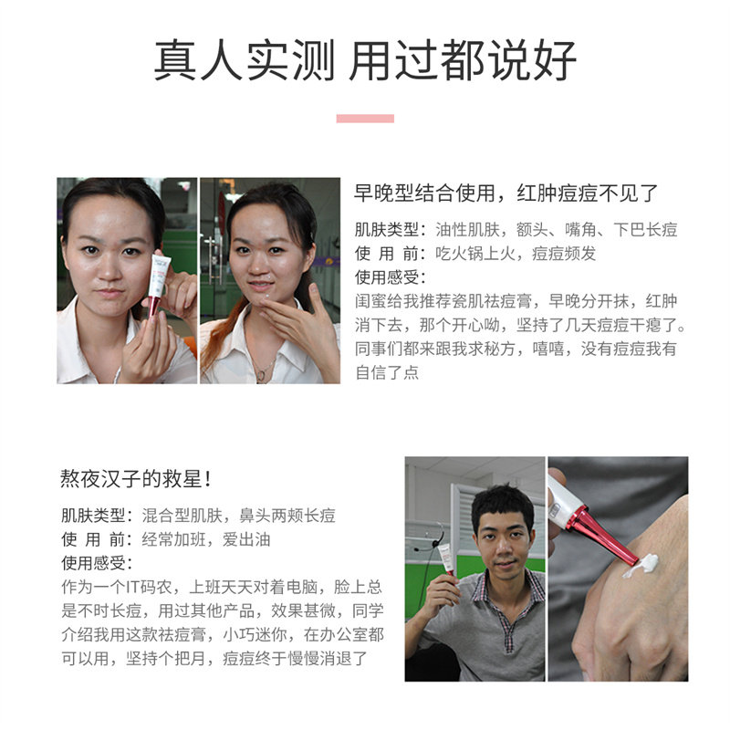 瓷肌早晚男女士痘痘膏快速祛痘膏 瓷肌乳液/面霜