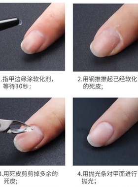 ZYZC俄式死皮软化液120ml