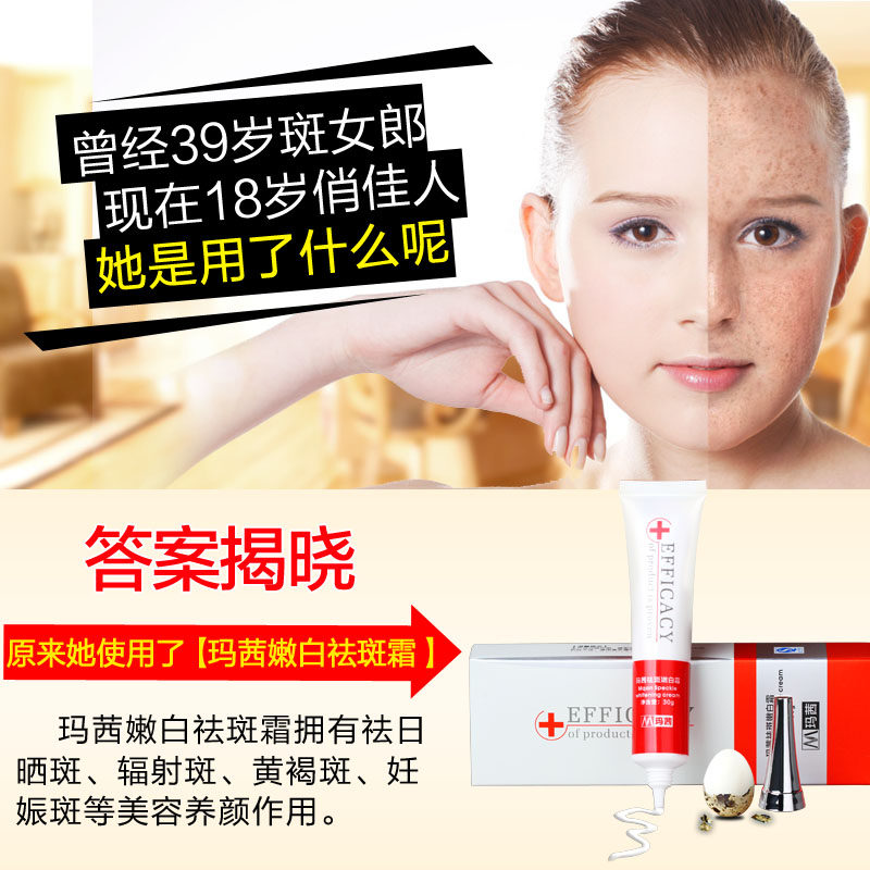 玛茜祛斑霜30g祛斑淡斑霜亮肤面霜 玛茜乳液/面霜