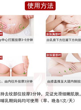 妊娠纹修复霜产后修护去孕纹淡化肥胖纹生长纹紧致膏祛舒缓疤痕膏