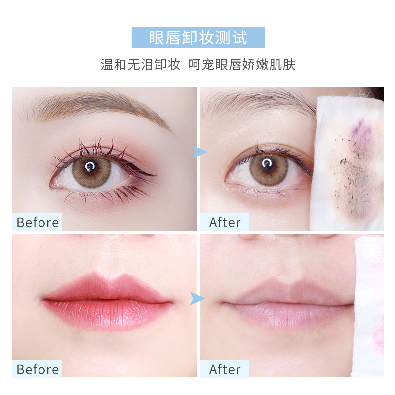 稚优泉化妆品旗舰店稚优泉酵素眼唇卸妆液卸妆水油脸部可用三合一温和清洁口红不刺激1