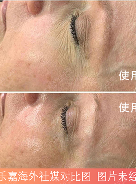 德美乐嘉冰感睡眠眼膜淡纹提亮