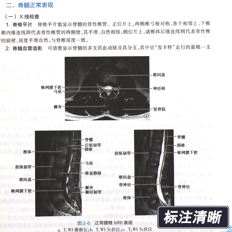 医学影像学 第8八版 白人驹 人卫十三五本科规划教材书西医临床医学第九9轮五年制病理内科诊断药理传染病全套人民卫生出版社考研 - 图0