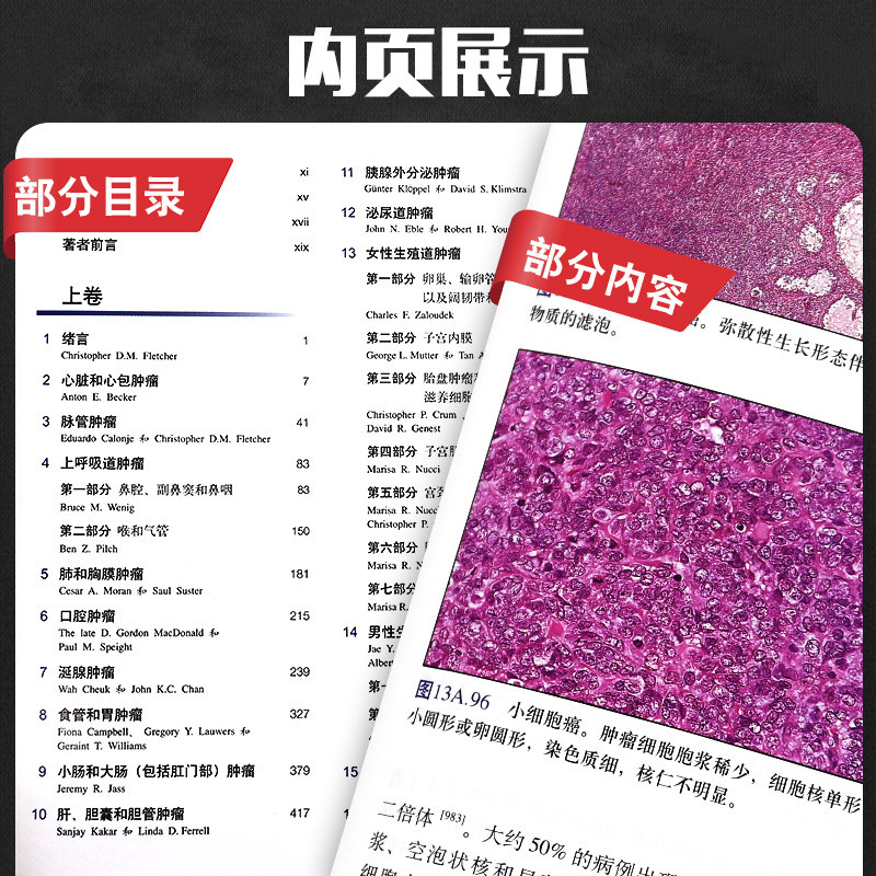 肿瘤组织病理学诊断 第3版上下 弗莱彻 基因表达谱和蛋白组学等更昂贵的现代技术可以应用 9787811167948 北京大学医学出版社