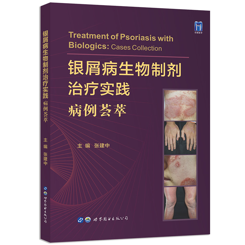 银屑病生物治疗实践病例荟萃制剂 盛世天佑图书皮肤病学/性病学