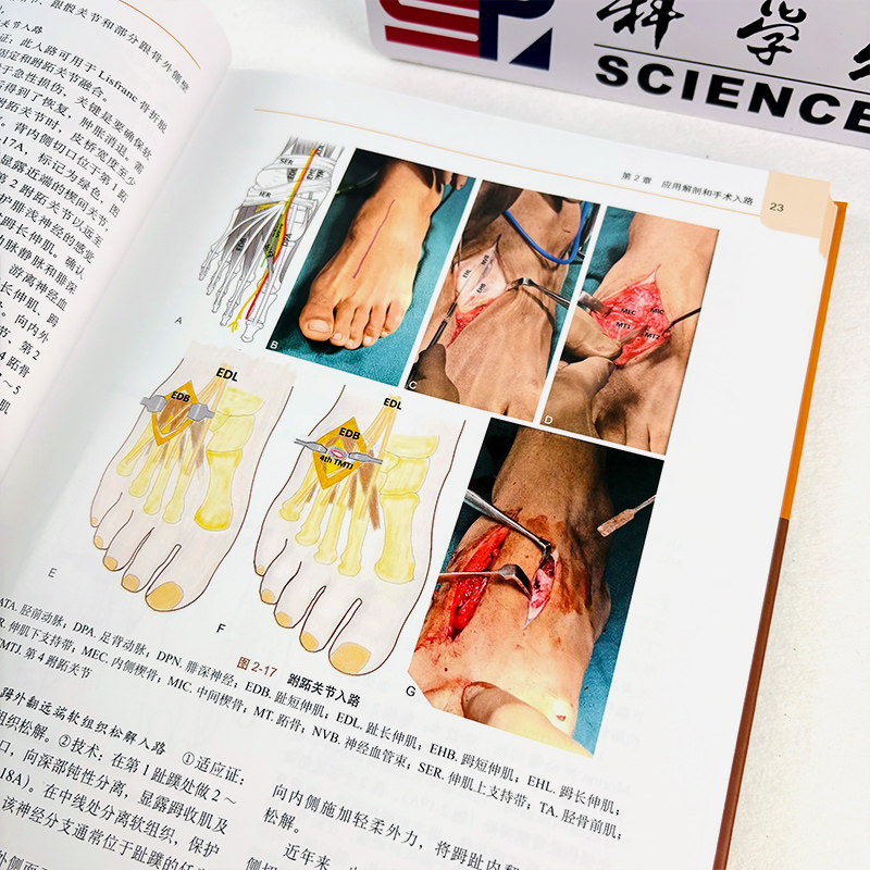 足踝外科精要中文翻译版 马尼斯巴迪亚编 足踝部解剖与生物力学创伤和骨病的诊治假肢与矫形器具及影像学检查等多方面 科学出版社