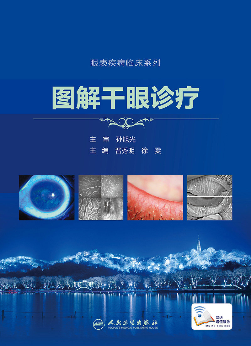 正版 图解干眼诊疗 眼表疾病临床系列 孙旭光 晋秀明 眼科书籍眼科学视光学专业书籍视光医生门诊笔记眼底病图谱 人民卫生出版社