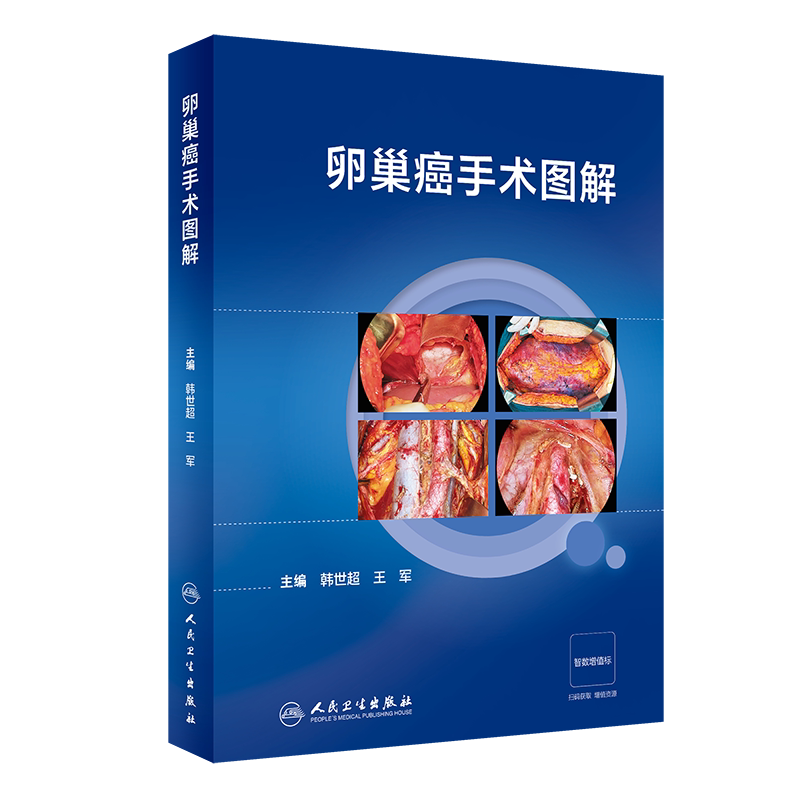 卵巢癌手术图解 人民卫生出版社 韩世超等 肿瘤细胞减灭术 腹主区域融合转移淋巴结切除术 卵巢癌手术相关解剖 阑尾切除术