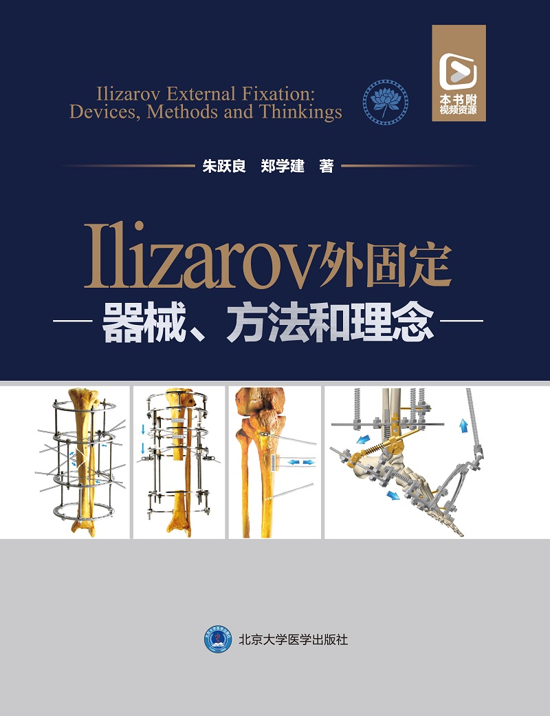 附视频 Ilizarov外固定 器械方法和理念 朱跃良郑学建 骨骼再生矫正修复牵拉性组织再生张力应力矫形外科技术牵拉成骨学实用骨科学 - 图1